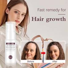 Сывороточная эссенция для роста волос, масло против выпадения волос, спрей для роста волос, лечение выпадения волос, натуральное масло, красота, уход за волосами, тоник для волос 2024 - купить недорого