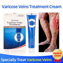 Varicose Veins Treatment Cold Compress Cream Relieve Vein Pain Phlebitis Health Care Plaster 2024 - buy cheap