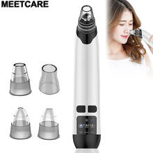 Electric Heating Blackhead Remover Vacuum Suction Pimple Black Dot Remover Face Acne Pore Cleaner Dermabrasion Machine Skin Care 2024 - buy cheap