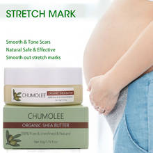 *CHUMOLEE Natural Unrefined Shea Butter Repair Maternity Stretch Marks Scar Body Hand Foot care Skin Care Body Cream 2024 - buy cheap