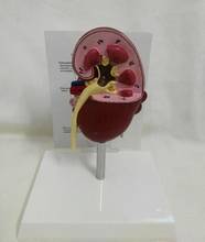 Anatomical model of pathological and healthy kidney in dogs Veterinary medicine teaching AIDS English instruction manual 2024 - buy cheap
