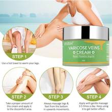 50g Varicose Vein Cream Medical Spider Veins Treatment Chinese Herbal Medicine Varicose Veins Ointment Antibacterial Hose Cream 2024 - buy cheap