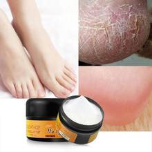 30g Natural Horse Oil Hand Foot Peeling Repair Cream Feet Massage For Athlete's Feet Itch Blisters Anti-chapping Foot Care TSLM2 2024 - buy cheap