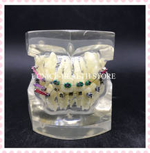 Dental Teaching and leaning Orthodontic teeth Model M3005/Fault Correction Dental Orthodontic teeth modle 2024 - buy cheap