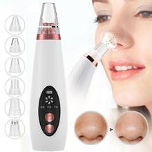 USB Rechargeable Blackhead Remover Face Pore Vacuum Skin Care Acne Pore Cleaner Pimple Removal Vacuum Suction Facial Tools 2024 - buy cheap