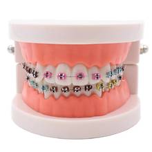 1 Piece Transparent Dental Orthodontic Teeth Model with Ceramic and Metal Brackets for Patient Communication 2024 - buy cheap