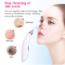 USB Blackhead Remover Face Pore Vacuum Skin Care Acne Pore Cleaner Pimple Removal Vacuum Suction Facial Tools puntos negros 2024 - buy cheap