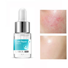 12ml Cutin Repair Face Serum Anti Allergic Shrink Pores Whitening Moisturizing Brightening Nourishing Facial Skin Care 2024 - buy cheap