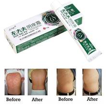 Herbal Skin Care Cream Male & Female Private Body Cream Ointment Dermatitis Eczema Pruritus Cream Skin Repair For Private Parts 2024 - buy cheap