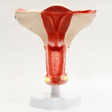 Female Uterus Ovary Anatomical Model Human Dissection  Pathology Uterus Model Medical Anatomy Teaching Tools BIX-A1201 2024 - buy cheap