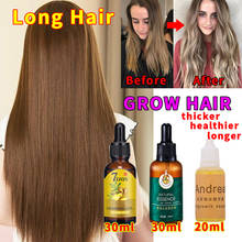 Esencia efectiva para el crecimiento del cabello, producto para el cuidado del cabello, rápido y grueso, para prevenir la caída del cabello, 30/20ML 2024 - compra barato
