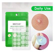 Acne Pimple Patch Acne Treatment Facial Acne Patch Skin Tag Hydrocolloid Pimple Cover Tag Fast Remover Pimple Stickers Makeup 2024 - buy cheap
