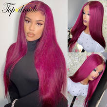 Topodmido Rose Pink Color 13x4 Transparent Lace Front Wigs with Baby Hair 13x6 Straight Human Hair Wig Brazilian Remy Hair Wigs 2024 - buy cheap