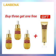 LANBENA Buy 3 Get 1 Gift Remove  Acne Scar Serum Acne Treatment Remover Stretch Marks Anti 3PCS+Acne Scar Removal Cream 2024 - buy cheap