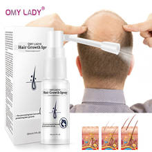 OMY LADY против выпадения волос спрей для роста волос эфирное масло жидкость для мужчин женщин мужчин восстановление сухих волос Восстановление выпадения волос масло для роста 2024 - купить недорого