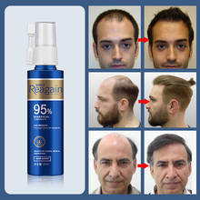 Hair Growth Essence Oil Anti Hair Loss Treatment for Beard Growth Oil Repair Damage Hair Roots Hair Care Products Hair Tonic 2024 - купить недорого