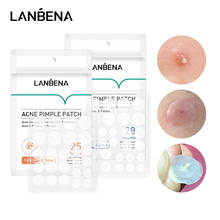 LANBENA Acne Pimple Patch Tea Tree Invisible Acne Treatment Stickers Blemish Spot Treatment Acne Scar Removal Repair Skin Care 2024 - buy cheap