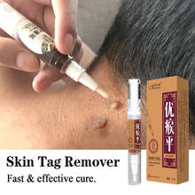 Skin Tag Remover  Against Mole & Genital Wart fast RemovWithin al Anti Foot Corn Removal Warts Papillomas Rapidly removes moles 2024 - buy cheap