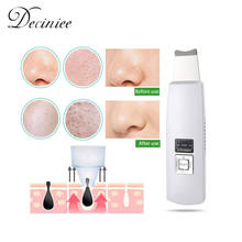 Portable Ultrasonic Skin Scrubber Face Cleanser Ultrasound Pore Wrinkle Remover Cleaner Face Lifting Skin Care Machine Devices 2024 - buy cheap