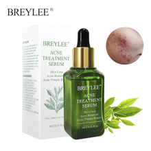 BREYLEE Acne Treatment Essence Facial Anti Acne Scar Removal Face Cream Whitening Repair Pimple Remover For Acne Serum Skin Care 2024 - buy cheap