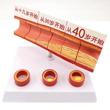 Human Age Vascular Obstruction Medical Model Clear Texture Easy to Carry Teaching Resources 2024 - buy cheap