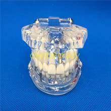 High Quality Dental Teeth Models Are Used For Teaching And Hospital Dentist Material 2024 - buy cheap