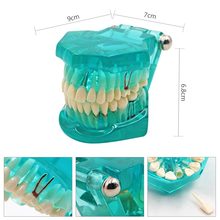 Modelo de dientes dentales de 1 pieza, modelo de implante de dientes orales, modelo de enseñanza, equipo de herramientas de entrenamiento desmontable 2024 - compra barato