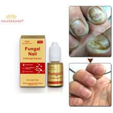 Fungal Nail Treatment Feet Care Essence Nail Foot Whitening Toe Nail Fungus Removal Gel Anti Infection Paronychia Onychomycosis 2024 - buy cheap