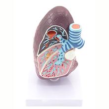 Modelo Médico de pulmones enfermos, sistema respiratorio de anatomía respiratoria para educación de pacientes, materiales didácticos 2024 - compra barato