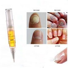 1pc 5ml Fungal Nail Treatment Pen Onychomycosis Paronychia Anti Fungal Nail Infection Chinese Herbal Care Medicinal Liquid TSLM1 2024 - buy cheap