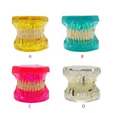 Dentes dentários destacáveis modelo com ponte de restauração dentista para o novo dentista traning estudo de ensino dental 2024 - compre barato