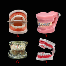 Dental Implant Disease Teeth Model With Restoration Bridge Tooth Dentist For Medical Science Dental Disease Teaching Study 2024 - buy cheap