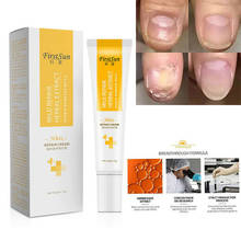 Nail Foot Protector Skin Care Cream Fungus Treatment Herb Nails Repair Cream 2024 - buy cheap