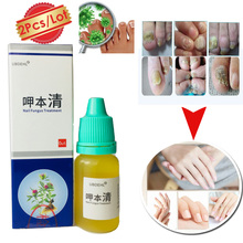 2 uds tratamiento de uñas Onychomycosis Paronychia infección de uñas Anti hongos buen resultado Herbal chino tratamiento de hongos para uñas de pies 2024 - compra barato