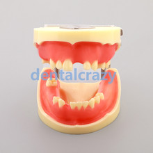 Modelo de prática de implante dentário, modelos de dentes dentais m2002, ferramentas, modelos de dentista, 1 peça 2024 - compre barato