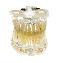Promotion Dental Study Tooth Transparent Adult Pathological Teeth Model Dental Lab Equipment Dentist Teaching 2024 - buy cheap