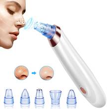 Electric Blackhead Remover Blackhead removal Acne Vacuum Cleaner Peeling Acne Pimple removal Pore Cleansing Blackhead Remover 2024 - buy cheap