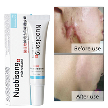 1pc Nuobisong facial scar removal Striae Gravidarum Pigmentation Corrector Anti-Aging cremas face Spots treatment stretch marks 2024 - buy cheap