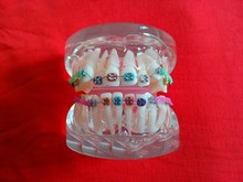 free shipping white transparent dental tooth Orthodontists model Malocclusion orthodontic models Teaching model Dental materials 2024 - buy cheap