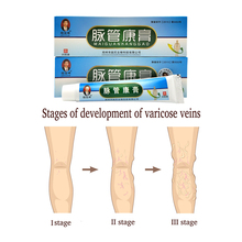 10pack Varicosity Medical Varicose Veins Cream Treatment Anti Foot Leg Vasculitis Phlebitis Herbal Product Medical Plaster 2024 - buy cheap