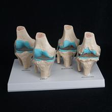 Modelo de articulação de joelho humano, modelo de esqueleto com 4 estágios para ensino de medicina, caveira 2024 - compre barato