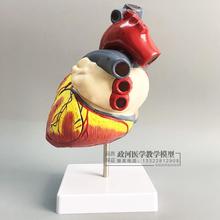 2.5X Human Heart Enlargement anatomical model 4 parts heart structure model with 59 marks 20*14*17CM 2024 - buy cheap