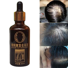 Сыворотка для роста волос китайская медицина рецепт семенной жидкости против выпадения волос. Потеря волос дополнительные эффекты густые волосы неправильный возврат 2024 - купить недорого