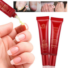 Nail Treatment 1PC 15G Fungal Nail Treatment Essence Nail And Foot Fungus Removal Feet Care Gel Nails Care 35 2024 - buy cheap