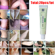 Hot selling 20pcs/lot ZUDAIFU Body Psoriasis Cream without Retail Box Skin Care 2024 - buy cheap