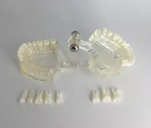 Modelo de dente de ciências médicas, modelo de demonstração de ensino destacável, modelo de cavidade oral, frete grátis 2024 - compre barato