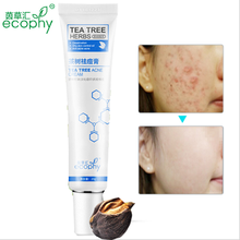 Tea Tree Extract Against Black Dots Face Cream Scar Removal Facial Blackhead Acne Treatment Bleaching Cream Skin Care 20ml 2024 - buy cheap