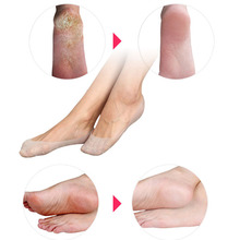 1 пара, силиконовые Увлажняющие гелевые носки на пятке, как трещины, защита и уход за кожей, массажер для ног, облегчение боли в ногах 2024 - купить недорого