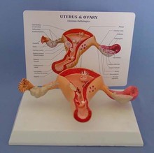 Uterus & Ovary Female genital uterus model vaginal ovary pathological changes obstetric structure teaching aids 2024 - buy cheap