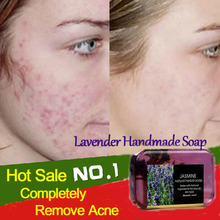 Skin Care Lavender Handmade Soap Anti-Acne Whitening Freckle Remove Blackhead Oil-Control Pure Natural Handmake Soap Face Care 2024 - buy cheap